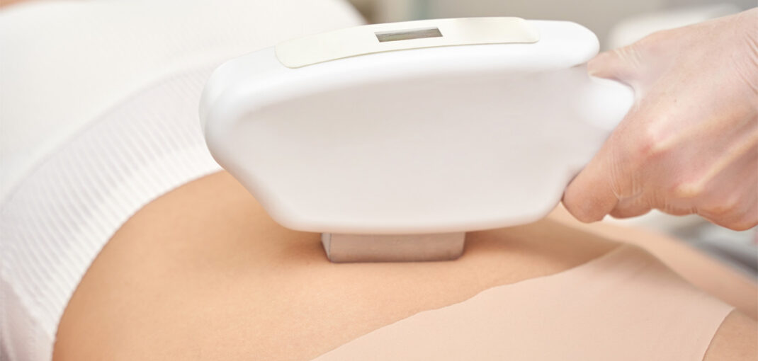 Emsculpt Neo work during non invasive body contouring treatment session