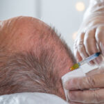 Peptide therapy benefits for longevity and wellness including recovery, metabolic support, and hormone balance